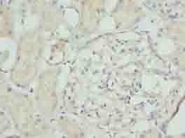 Polyclonal Rabbit anti-Human NFAM1 Antibody (IHC)