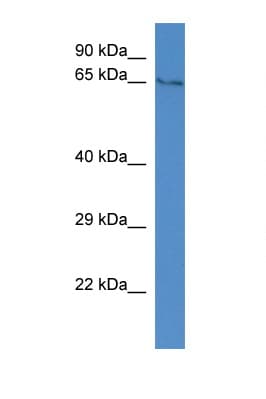 Polyclonal Rabbit anti-Rat TYRP1 / gp75 Antibody (aa380-429, WB)