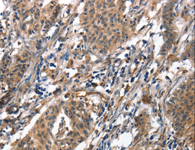 ALOX15 / 15-Lipoxygenase Antibody