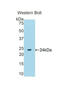 CYP19 / Aromatase Antibody (aa196-373)