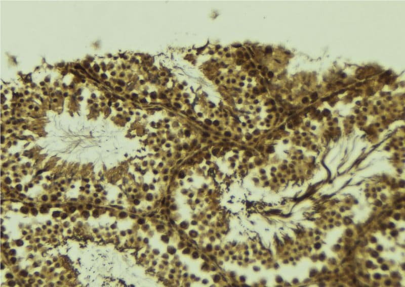SETDB2 Antibody