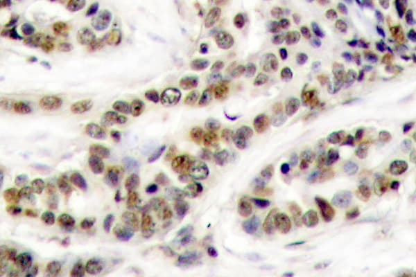 CREB1 / CREB Antibody (phospho-Ser129)