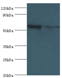 PLAP / Alkaline Phosphatase Antibody (aa260-520)