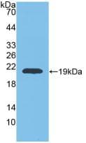 MMP9 / Gelatinase B Antibody (aa226-391)