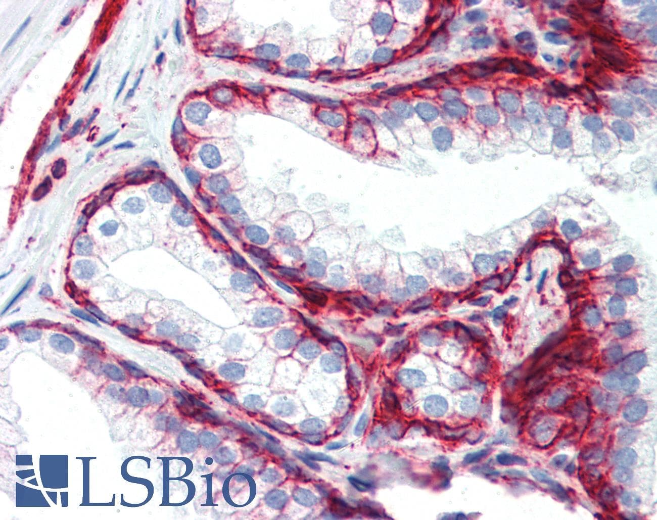 PathPlus™ CD44 Antibody (clone MEM-85)