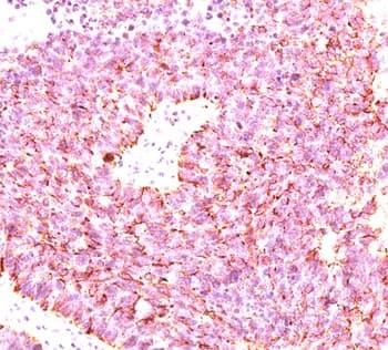 CHGA / Chromogranin A Antibody (clone LK2H10 + PHE5 + CGA414, Ready-to-Use)