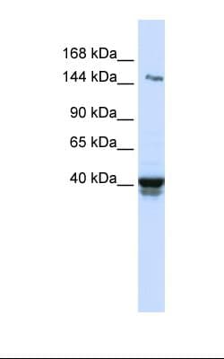 Polyclonal Rabbit anti-Human IGSF9 Antibody (aa74-123, WB)