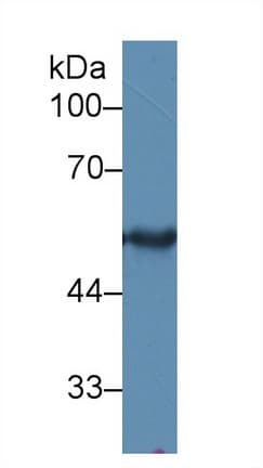 KRT15 / CK15 / Cytokeratin 15 Antibody (aa274-399)