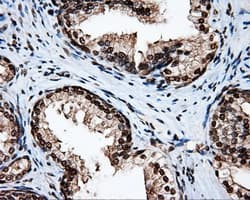 Monoclonal Mouse anti-Human APP / Beta Amyloid Precursor Antibody (clone OTI9E2, IHC, IF, WB)