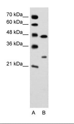 CLDN18 / Claudin 18 Antibody (C-Terminus, HRP)