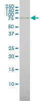 ABCF2 Antibody (clone 1D11)