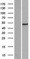 TADA2B Protein (Over-Expression Lysate Myc-DDK (Flag))