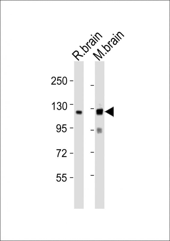 NLGN3 / Neuroligin 3 Antibody (aa651-685)