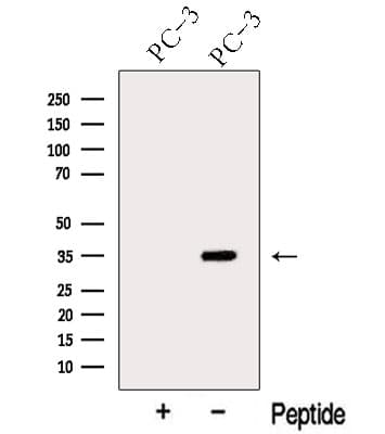 Polyclonal Rabbit anti-Human ARPC2 / p34-Arc Antibody (WB)