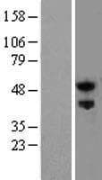 RTN4R Protein (Over-Expression Lysate Myc-DDK (Flag))