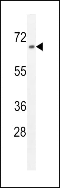 ZNF169 Antibody (aa131-159)
