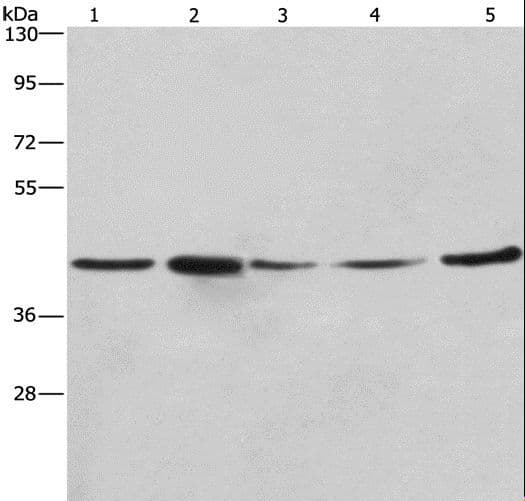 Polyclonal Rabbit anti-Human RPSA / Laminin Receptor Antibody (WB)