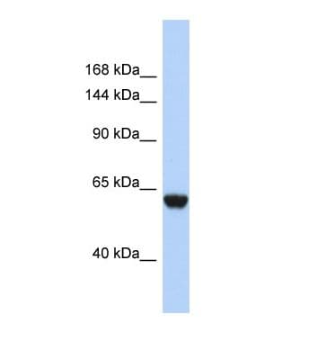 CFHR4 Antibody (N-Terminus)