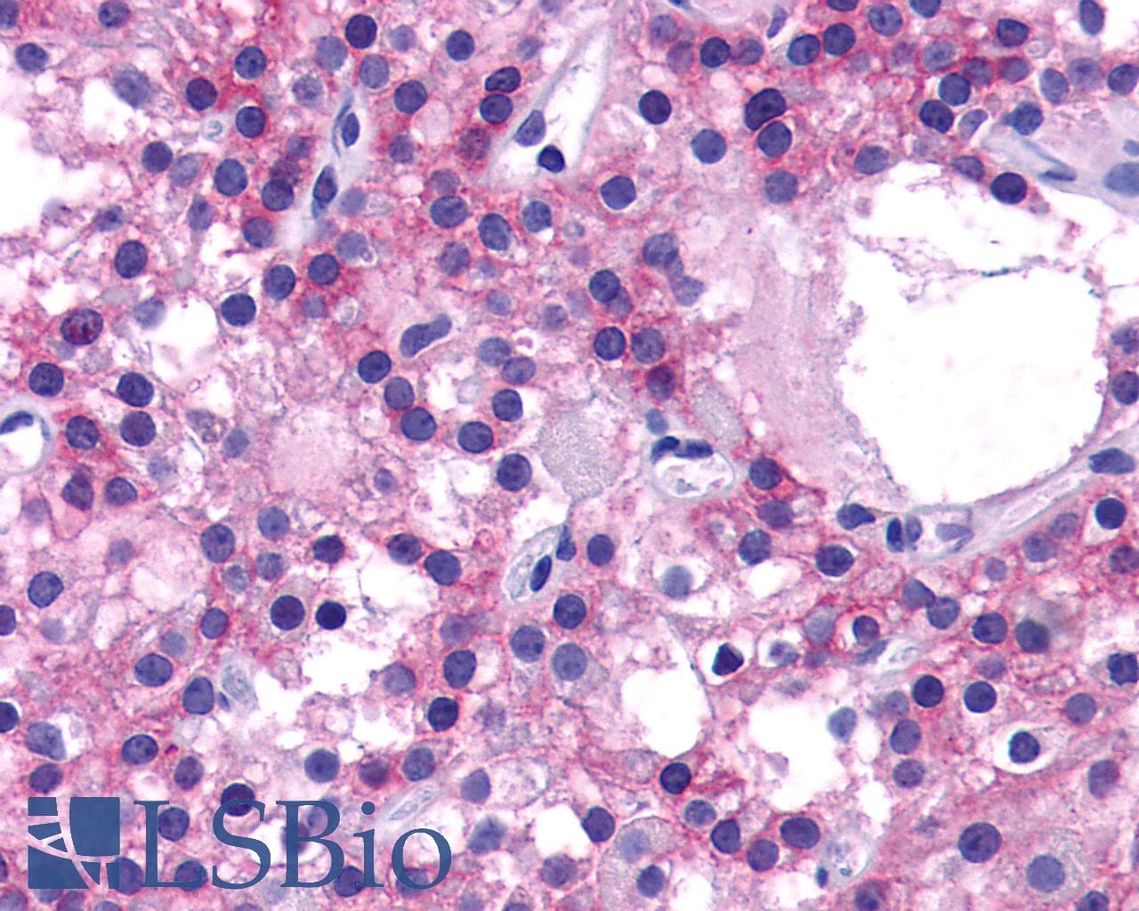 PathPlus™ Polyclonal Rabbit anti-Human CASR/Calcium Sensing Receptor Antibody (N-Terminus, IHC)