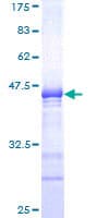 Human SOX6 Protein (Recombinant GST, N-terminus)