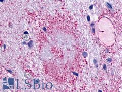 PathPlus™ LPAR5 / GPR92 Antibody (Cytoplasmic Domain)