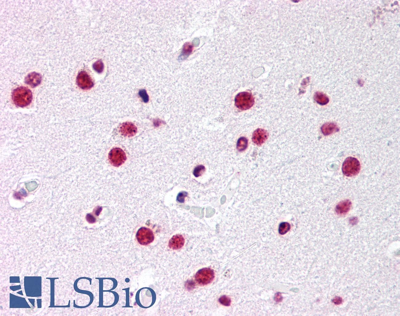 IHC-plus™ NR5A1 / SF1 Antibody (Ligand-binding Domain)
