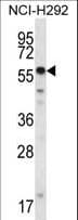 SMYD2 Antibody (aa120-152)