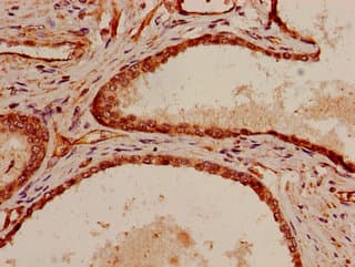p66 / SHC Antibody