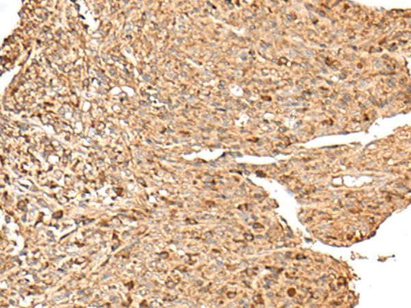RPS12 / Ribosomal Protein S12 Antibody
