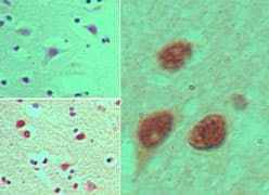 NUP35 / NUP53 Antibody (aa280-330)