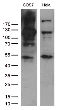 RB1 / Retinoblastoma / RB Antibody (aa309-590, clone OTI13A6)