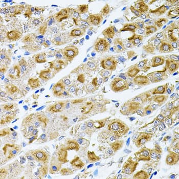IHC-plus™ MTTP / MTP Antibody