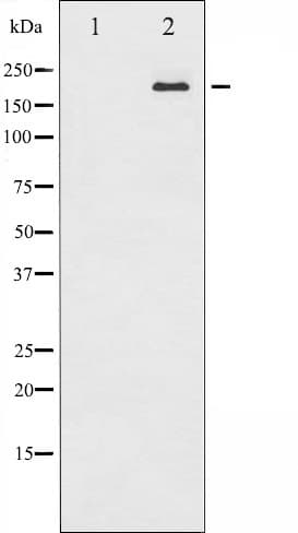 Tuberin / TSC2 Antibody