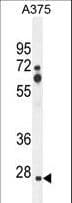 ZCCHC17 / PNO40 / PS1D Antibody (aa159-187)