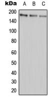 ABCA9 Antibody (Internal)