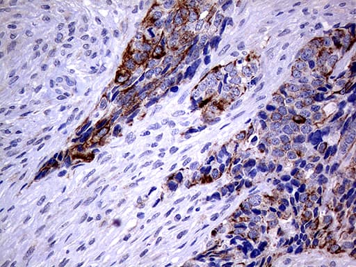 KRT8 / CK8 / Cytokeratin 8 Antibody (aa91-381, clone OTI2F5)