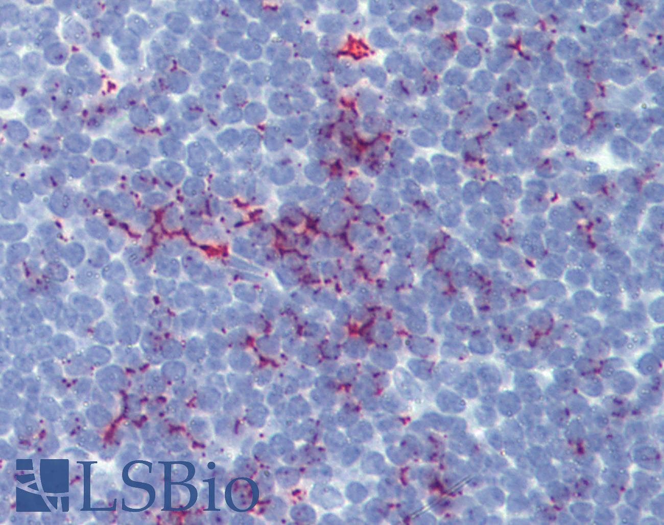 IHC-plus™ Polyclonal Rabbit anti-Human SENP1 Antibody (aa28-59, IHC, WB)
