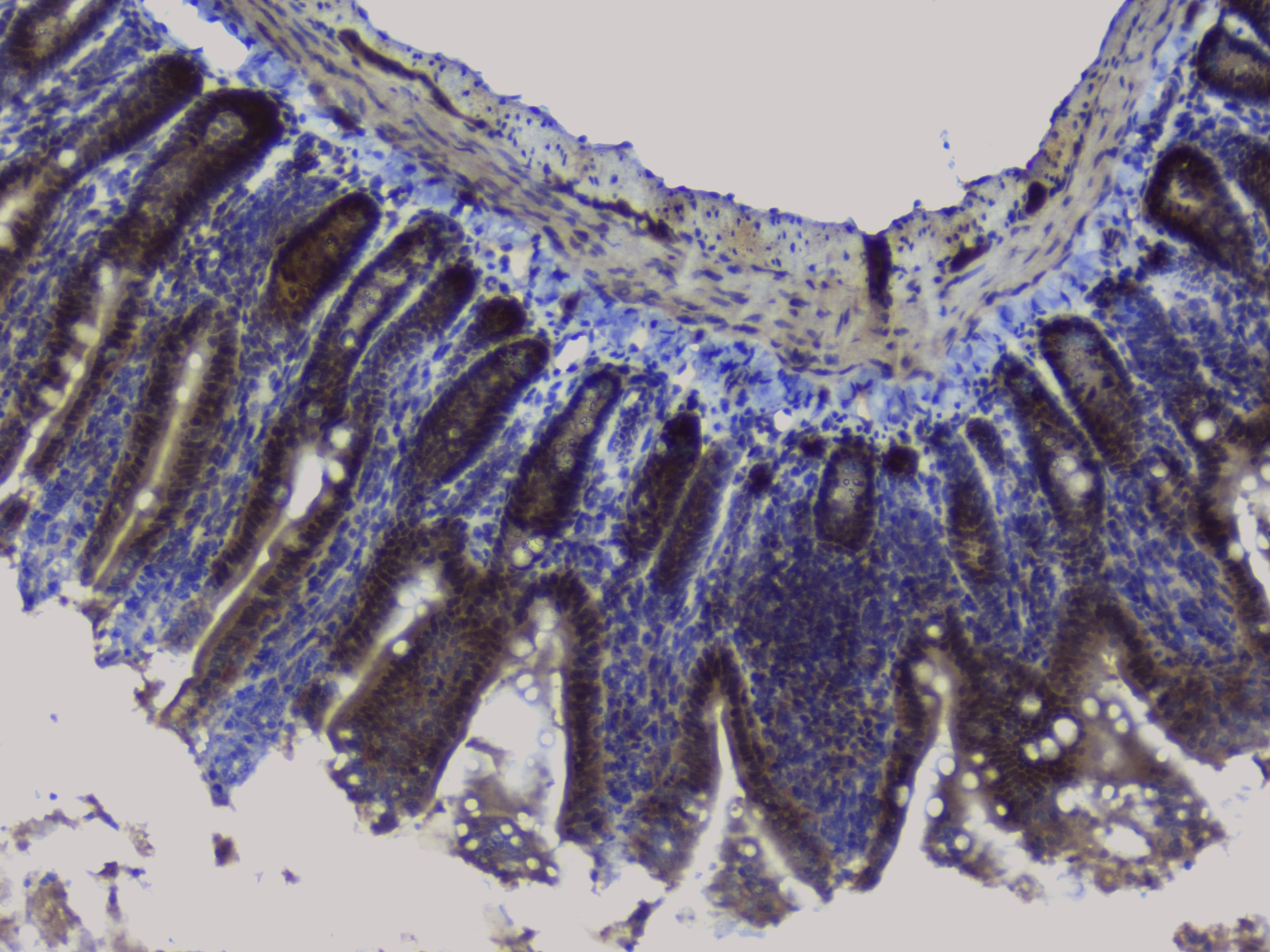 NRF1 / NRF-1 Antibody