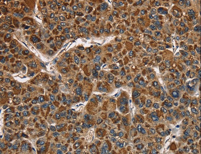 CAT / Catalase Antibody