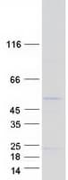 Human FAM167B Protein (Recombinant Myc-DDK (Flag))
