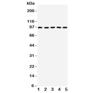 NTRK3 / TRKC Antibody (aa167-182)