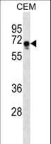 FEM1C Antibody (aa455-481)