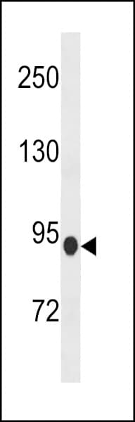 PDE8B Antibody (aa296-324)