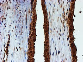 PSMB9 Antibody (clone OTI2B6)