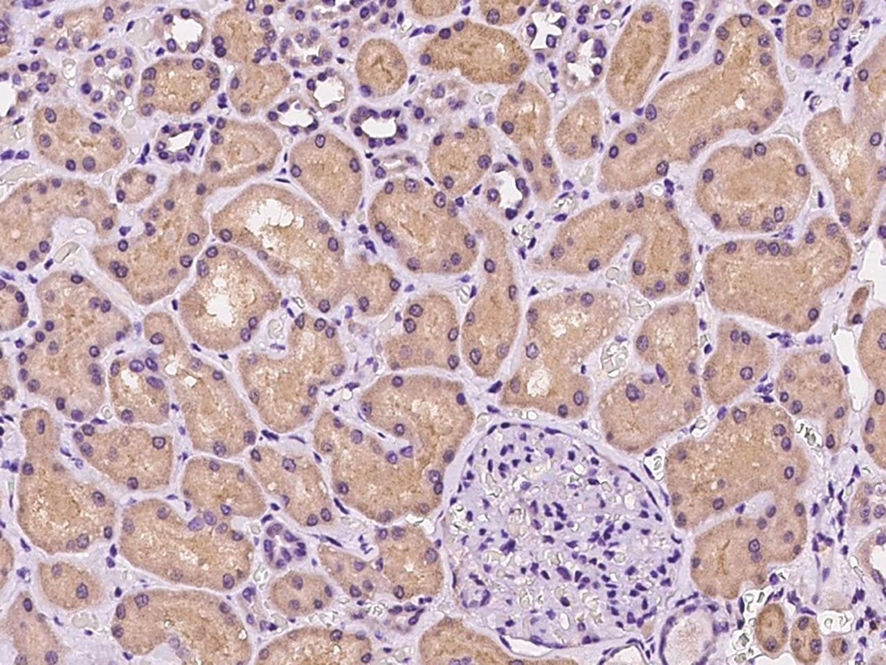 TAPBPL / TAPBPR Antibody