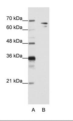 SF1 Antibody (N-Terminus)