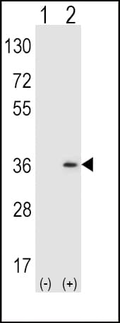 SULT1A1 / Sulfotransferase 1A1 Antibody (aa128-160)