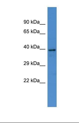 KNG1 / Kininogen / Bradykinin Antibody (aa40-89, HRP)