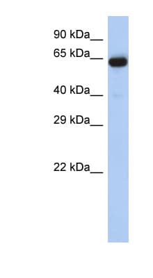 LRRTM1 Antibody (aa179-228)