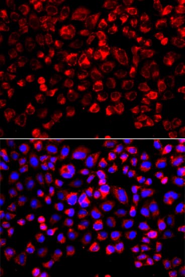 Polyclonal Rabbit anti-Human SULT1E1 / Sulfotransferase 1E1 Antibody (IHC, IF, WB)